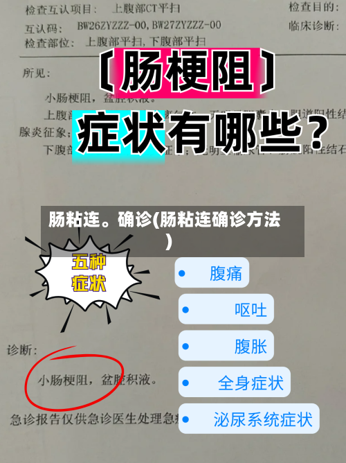 肠粘连。确诊(肠粘连确诊方法)-第3张图片