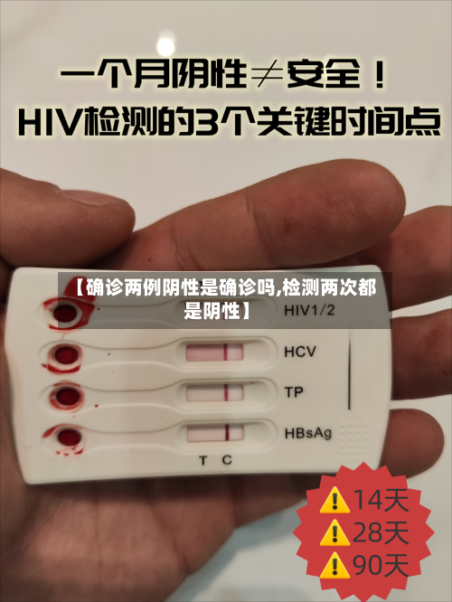 【确诊两例阴性是确诊吗,检测两次都是阴性】-第2张图片